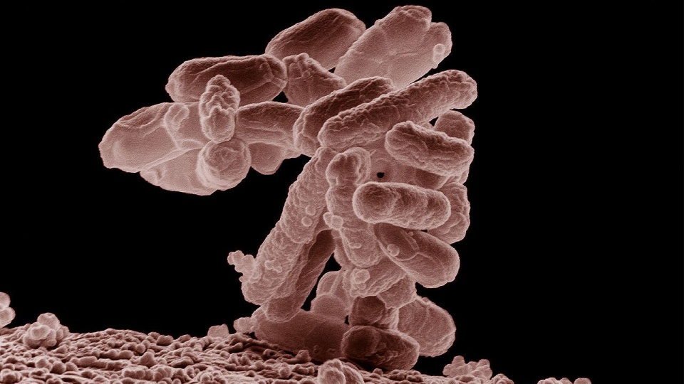 Skupisko Escherichia coli powiększone 10.000 x źródło: pl.wikipedia.org/wiki/Pałeczka_okrężnicy
