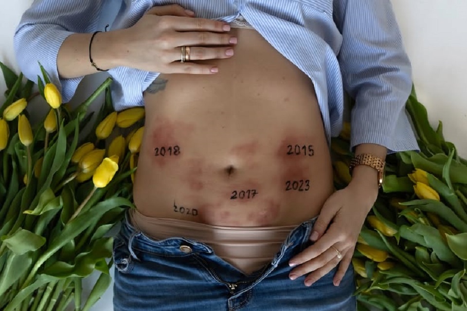 Historia przeprowadzonych operacji; fot.N. Matejska