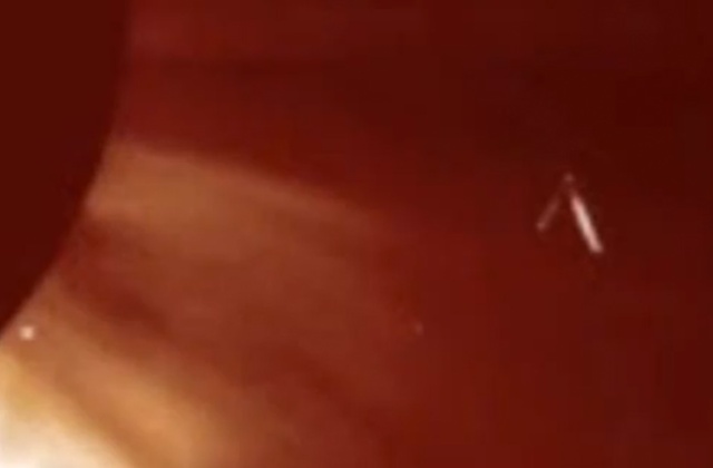 Na opublikowanych przez NASA fotografiach można zobaczyć dziwne obiekty w kształcie trójkątów. Zagadkowe zjawisko uwieczniła sonda LASCO wysłana w ramach projektu SOHO przez amerykańską agencję NASA oraz Europejską Agencję Kosmiczną.