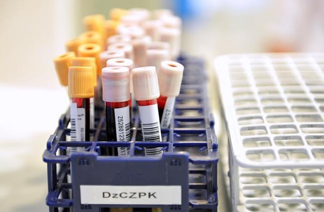 Osoby po 26. roku życia, chorujące na cukrzycę typu I, zapłacą mniej za leki. Od 1 stycznia zestawy infuzyjne do osobistej pompy insulinowej będą w części refundowane.