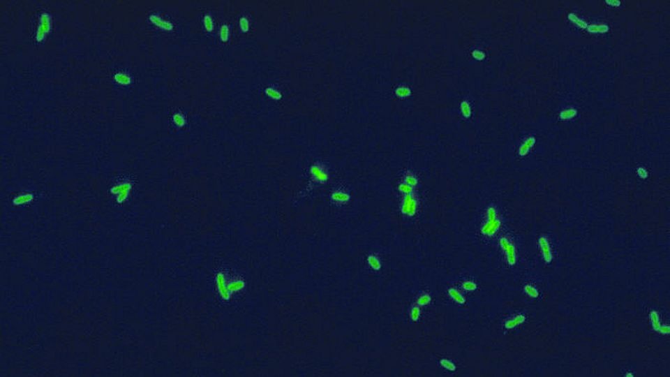 Fluoryzyjące komórki bakterii Legionella. Fot. wikipedia.org