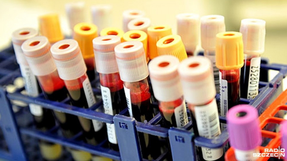 Lipidogram to badanie, które określa poziom cholesterolu we krwi. Fot. Łukasz Szełemej [Radio Szczecin/Archiwum]