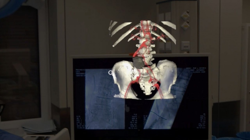 Zrzuty ekranu widocznego przez gogle Microsoft HoloLens. Fot. Samodzielny Publiczny Szpital Kliniczny Nr 2