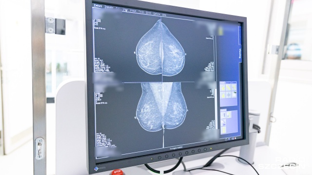 Fot. Robert Stachnik [Radio Szczecin] Dzięki mobilnemu mammografowi przebadanych zostanie tysiące kobiet [WIDEO, ZDJĘCIA]