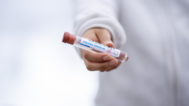 Ministerstwo Zdrowia: w skali kraju 135 nowych, pozytywnych testów