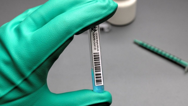 Zakażeni są pracownicy sanepidu w Myśliborzu. Stacja została tymczasowo zamknięta, a jej obowiązki przejął sanepid gryfiński i to właśnie z nim powinni teraz kontaktować się mieszkańcy Myśliborza.