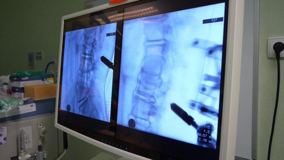 źródło: Samodzielny Publiczny Wojewódzki Szpital Zespolony