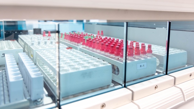 Fot. Robert Stachnik [Radio Szczecin] Najnowocześniejsze laboratorium w regionie już w komplecie [WIDEO, ZDJĘCIA]