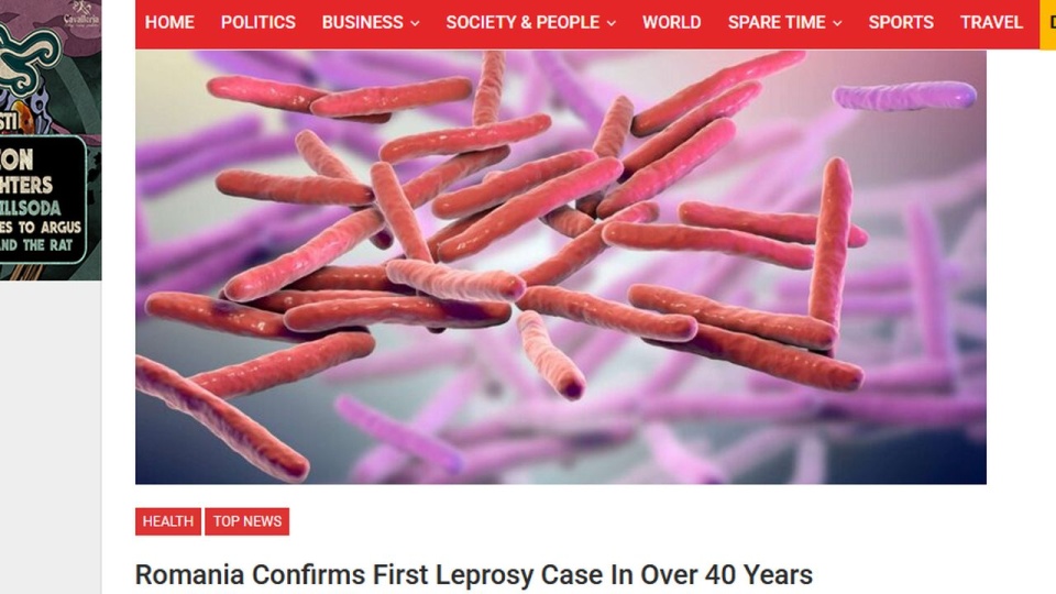 Ostatni przypadek trądu wykryto Rumunii w 1981 r. Także w innych krajach Europy są one bardzo rzadkie i dotyczą przede wszystkim osób przybywających z Azji, Afryki, lub Ameryki Południowej. źródło: www.romaniajournal.ro