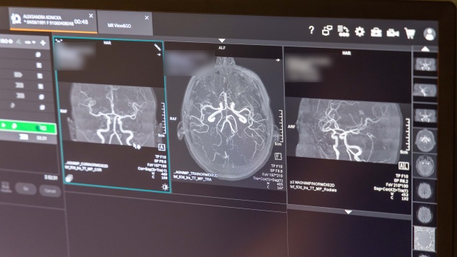 Fot. Robert Stachnik [Radio Szczecin] Rezonans w szpitalu MSWiA dostępny dla pacjentów z klaustrofobią [WIDEO, ZDJĘCIA]