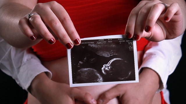 Endometrioza dotyka coraz więcej kobiet. Przewlekły stan zapalny może prowadzić do braku płodności.